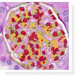 병리학 및 면역조직화학 (Pathology & Immunohistochemistry)