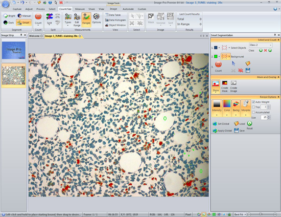 Segment Difficult Objects with Smart Segmentation